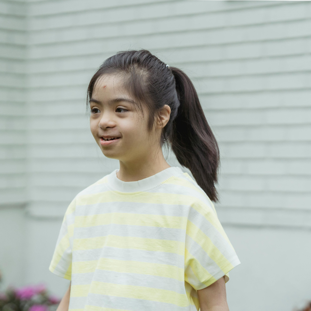 متلازمة داون